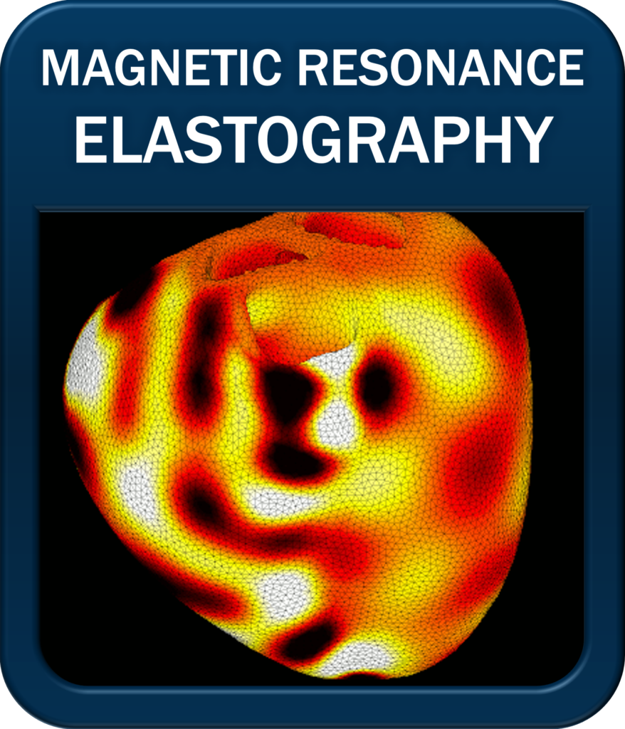 magentic resonance elastography